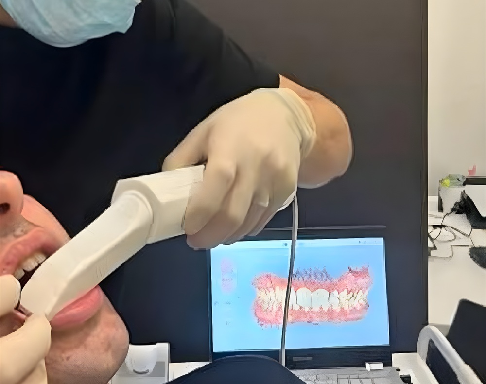 Intra Oral 2